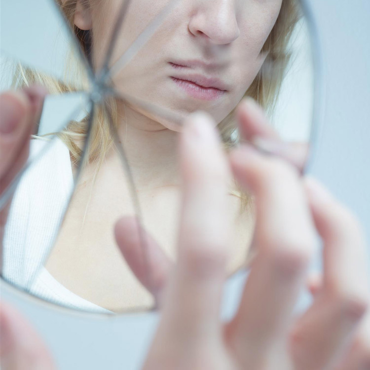 Woman With Psychosis Disorder